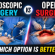 Illustration comparing laparoscopic surgery and open surgery procedures