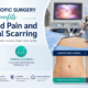 Laparoscopic Surgery Benefits