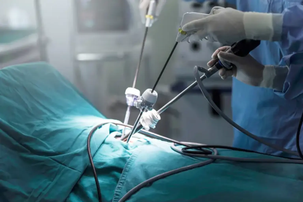 Laparoscopic Surgery Benefits