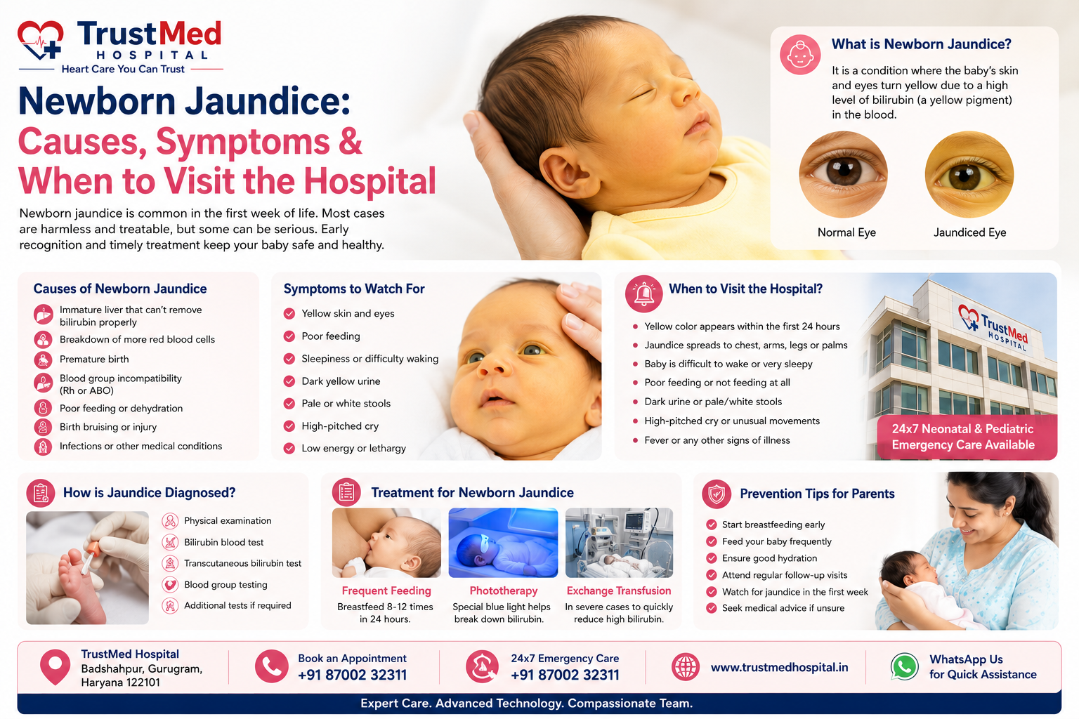 Newborn jaundice - TrustMed Hospital Badshahpur Gurgaon