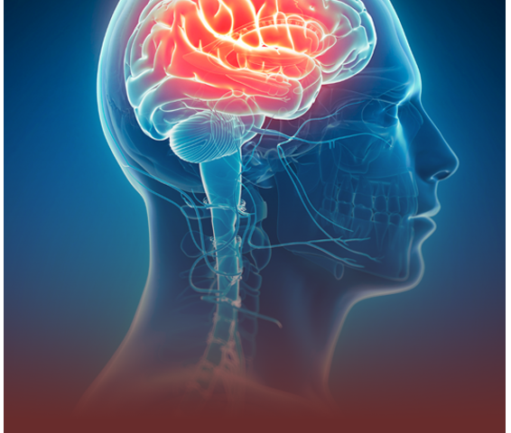 Migraine treatment Gurgaon neurology brain illustration at TrustMed Hospital