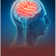 Migraine treatment Gurgaon neurology brain illustration at TrustMed Hospital